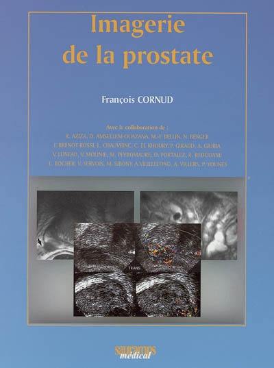 Imagerie de la prostate