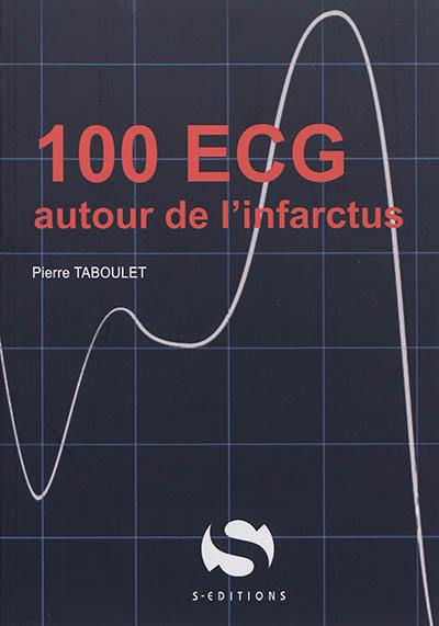 100 ECG autour de l'infarctus