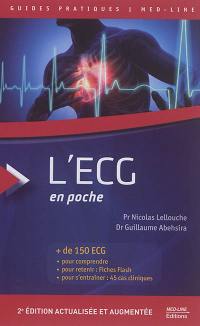 L'ECG en poche