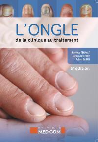 L'ongle : de la clinique au traitement