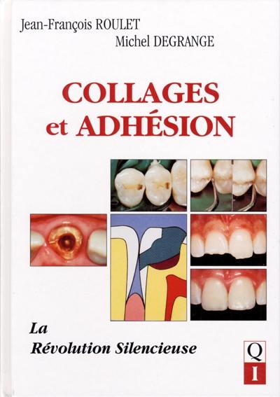 Collage et adhésion : la révolution silencieuse