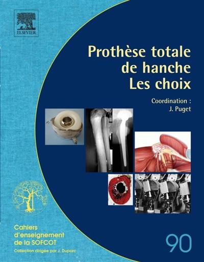 Prothèse totale de la hanche : les choix