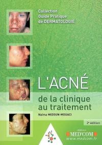 L'acné de la clinique au traitement