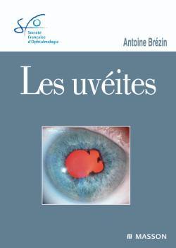 Les uvéites