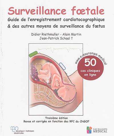 Surveillance foetale : guide de l'enregistrement cardiotocographique et des autres moyens de surveillance du foetus