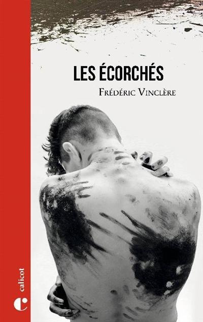 Les écorchés