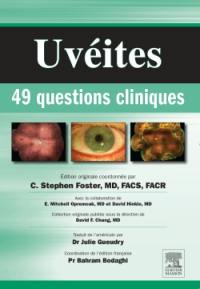 Uvéites : 49 questions cliniques