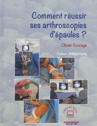 Comment réussir ses arthroscopies d'épaules ?