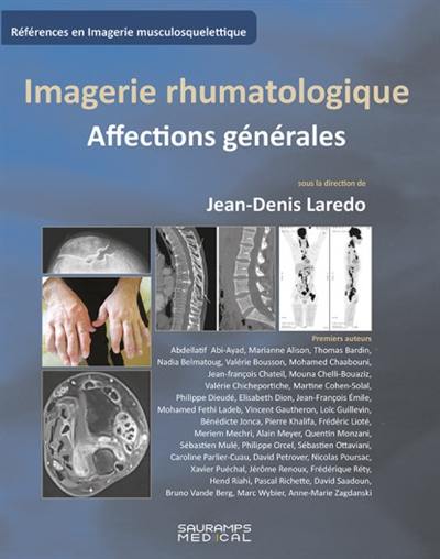 Imagerie rhumatologique : affections générales