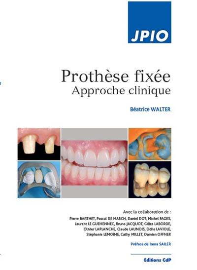 Prothèse fixée : approche clinique