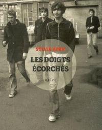 Les doigts écorchés