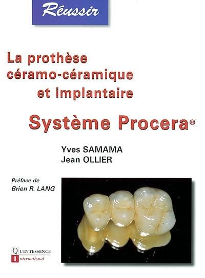 La prothèse céramo-céramique et implantaire : système Procera(R)