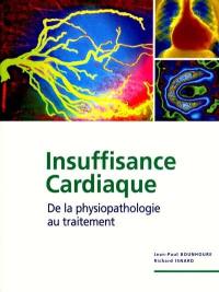 Insuffisance cardiaque : de la physiopathologie au traitement