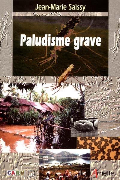 Paludisme grave