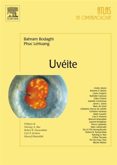 Uvéite