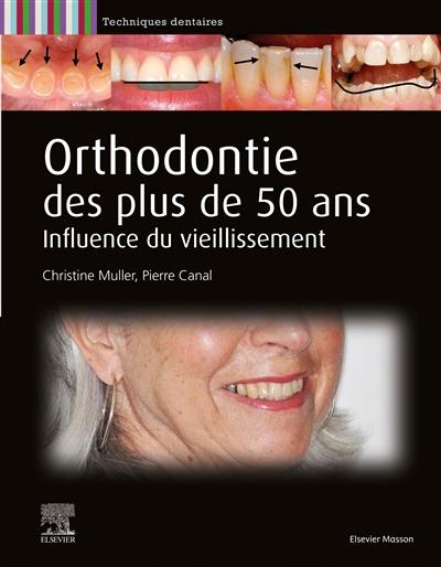 Orthodontie des plus de 50 ans : influence du vieillissement