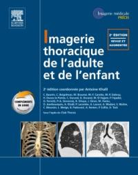 Imagerie thoracique de l'adulte et de l'enfant