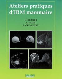 Ateliers pratiques d'IRM mammaire