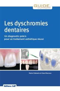 Les dyschromies dentaires : un diagnostic précis pour un traitement esthétique réussi