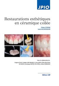 Restaurations esthétiques en céramique collée