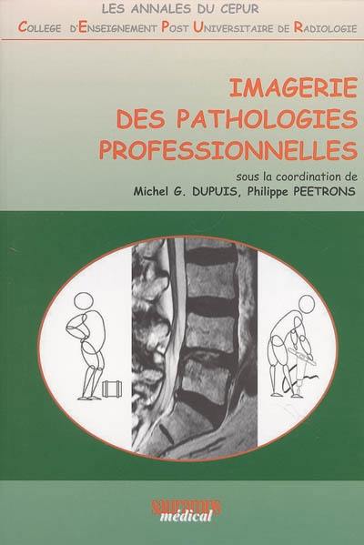 Imagerie des pathologies professionnelles