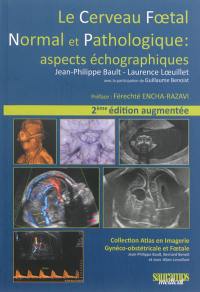 Le cerveau foetal normal et pathologique : aspects échographiques