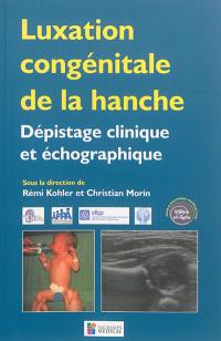 Luxation congénitale de la hanche : dépistage clinique et échographique