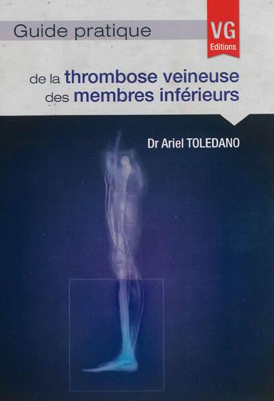 Guide pratique de la thrombose veineuse des membres inférieurs