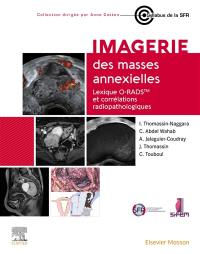 Imagerie des masses annexielles : lexique O-RADS et corrélations radiopathologiques