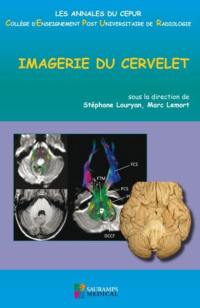 Imagerie du cervelet