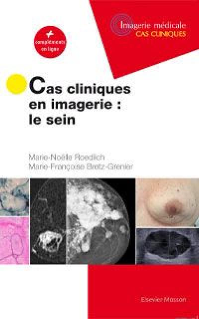 Cas cliniques en imagerie : le sein : + compléments en ligne