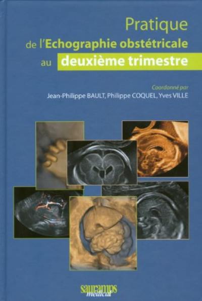 Pratique de l'échographie obstétricale au deuxième trimestre