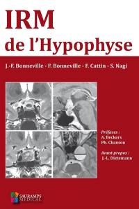 IRM de l'hypophyse