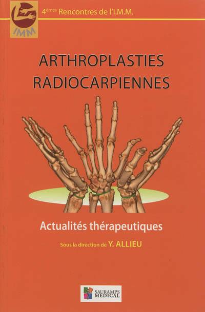 Arthroplasties radiocarpiennes : actualités thérapeutiques