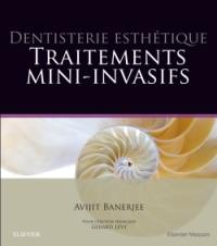 Dentisterie esthétique : traitements mini-invasifs