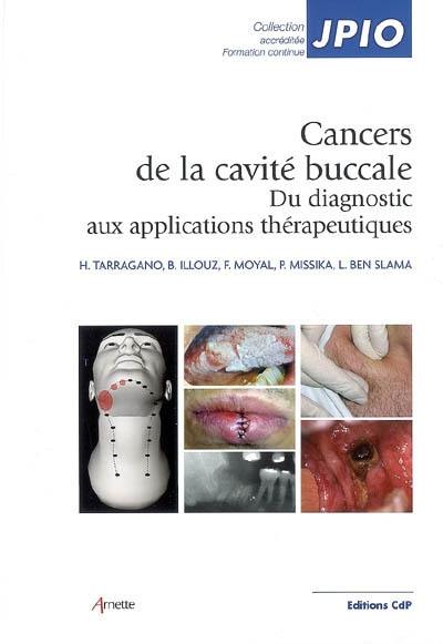 Cancers de la cavité buccale : du diagnostic aux applications thérapeutiques