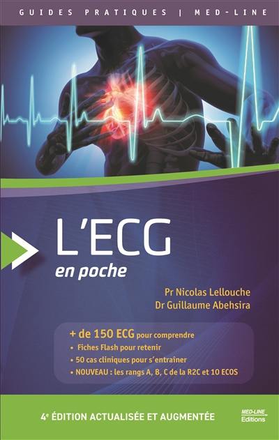 L'ECG en poche