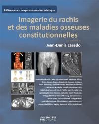 Imagerie du rachis et des maladies osseuses constitutionnelles : rachis de l'adulte et maladies osseuses de l'enfant vues à l'âge adulte