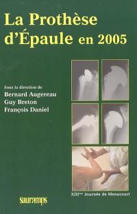 La prothèse d'épaule en 2005