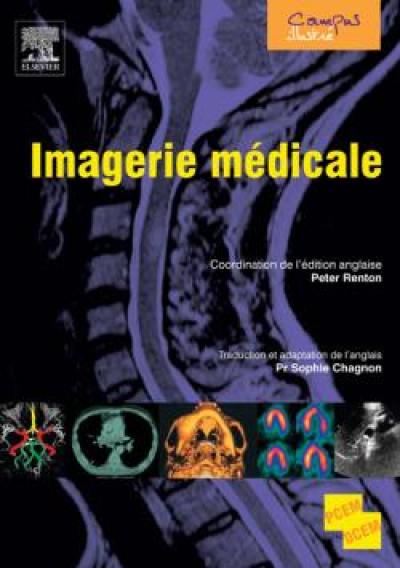 Imagerie médicale