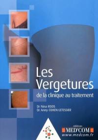 Les vergetures : de la clinique au traitement