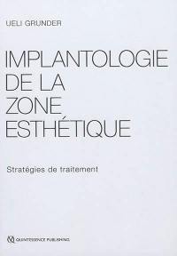 Implantologie de la zone esthétique : stratégies de traitement