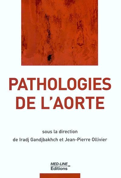 Pathologies de l'aorte