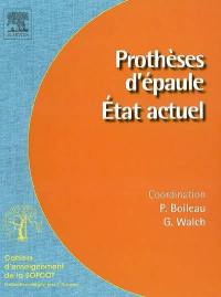 Prothèses d'épaule : état actuel