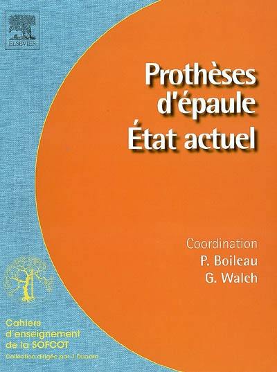 Prothèses d'épaule : état actuel