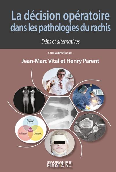 La décision opératoire dans les pathologies du rachis : défis et alternatives