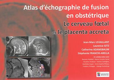 Atlas d'échographie de fusion en obstétrique : le cerveau foetal et le placenta accreta