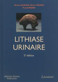 La lithiase urinaire