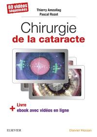 Chirurgie de la cataracte : 80 vidéos séquencées : livre + ebook avec vidéos en ligne