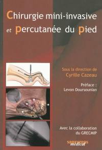 Chirurgie mini-invasive et percutanée du pied